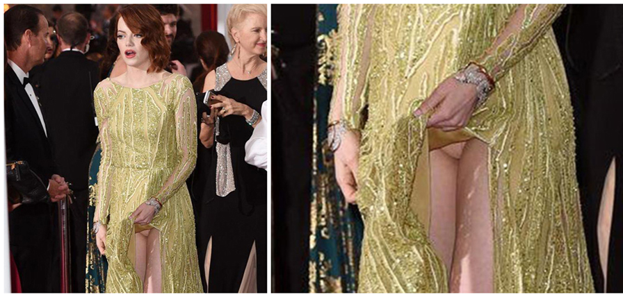 Emma Stone Upskirt At Academy Awards 2015 Scandalpost