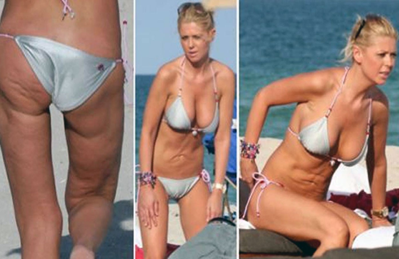 Tara Reid Bikini - Bad Liposuction Pics.